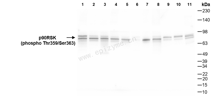 Anti-Phospho-RSK1 p90 (Thr359/Ser363) Rabbit mAb [63J43T90]