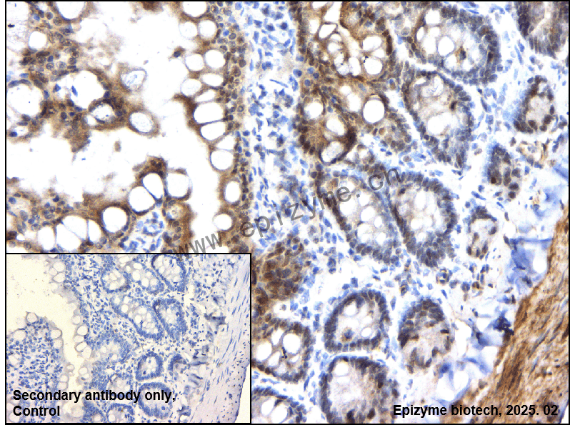 Anti-Phospho-RSK1 p90 (Thr359/Ser363) Rabbit mAb [63J43T90]