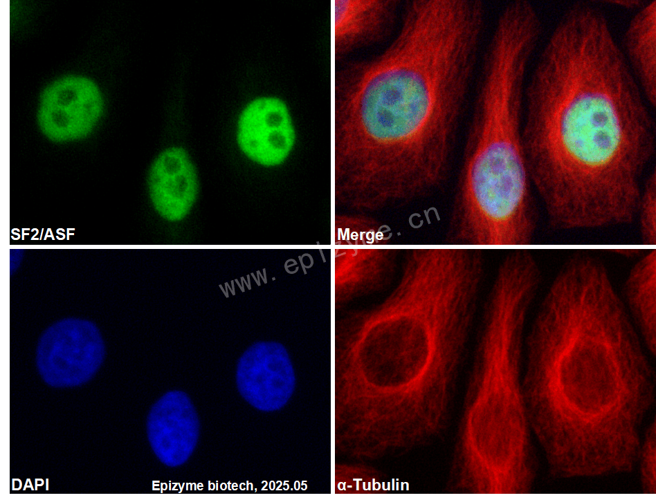Anti-SF2 Rabbit mAb [17M78S84]