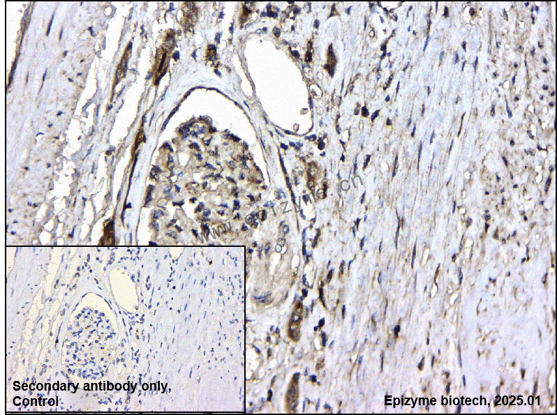 Anti-TMPRSS2 Rabbit mAb [70D26N95]
