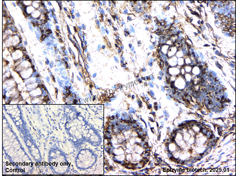 Anti-TMPRSS2 Rabbit mAb [70D26N95]