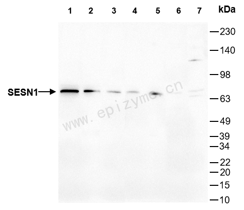 Anti-SESN1 Rabbit mAb [16T24J96]