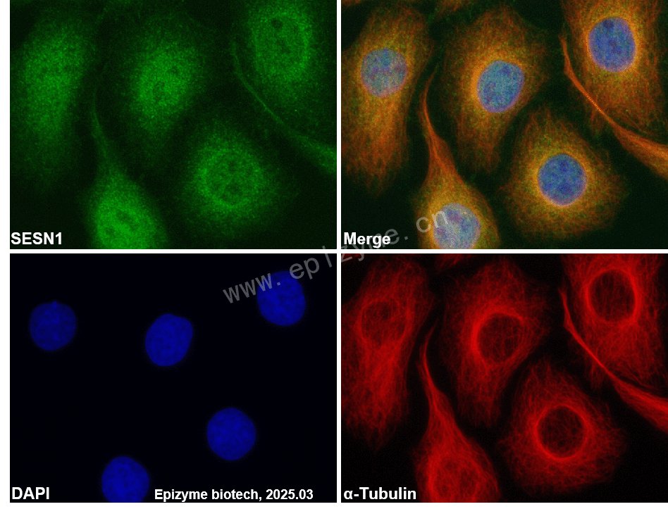 Anti-SESN1 Rabbit mAb [16T24J96]