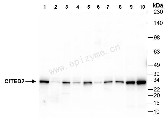 Anti-CITED2 Rabbit mAb [70A08L89]