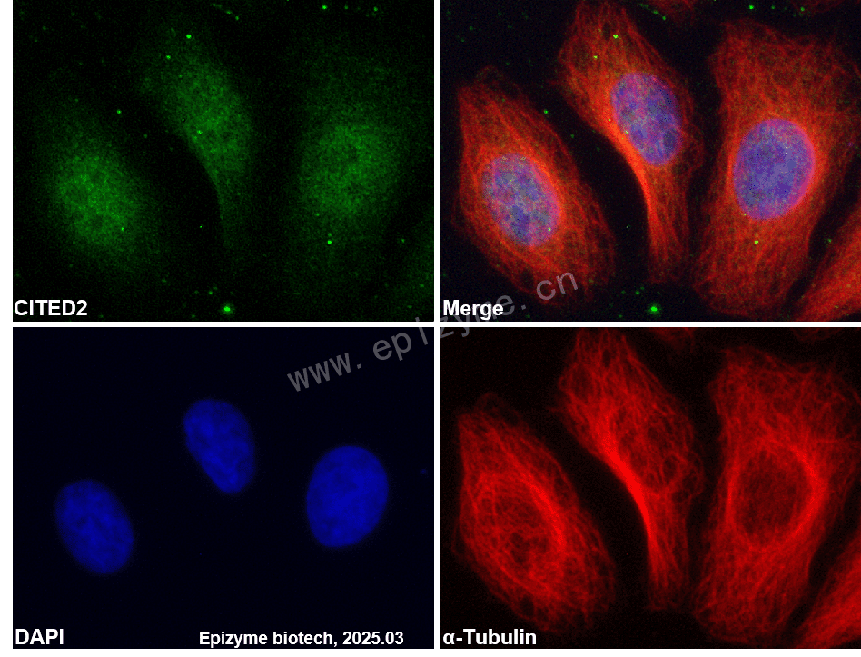 Anti-CITED2 Rabbit mAb [70A08L89]