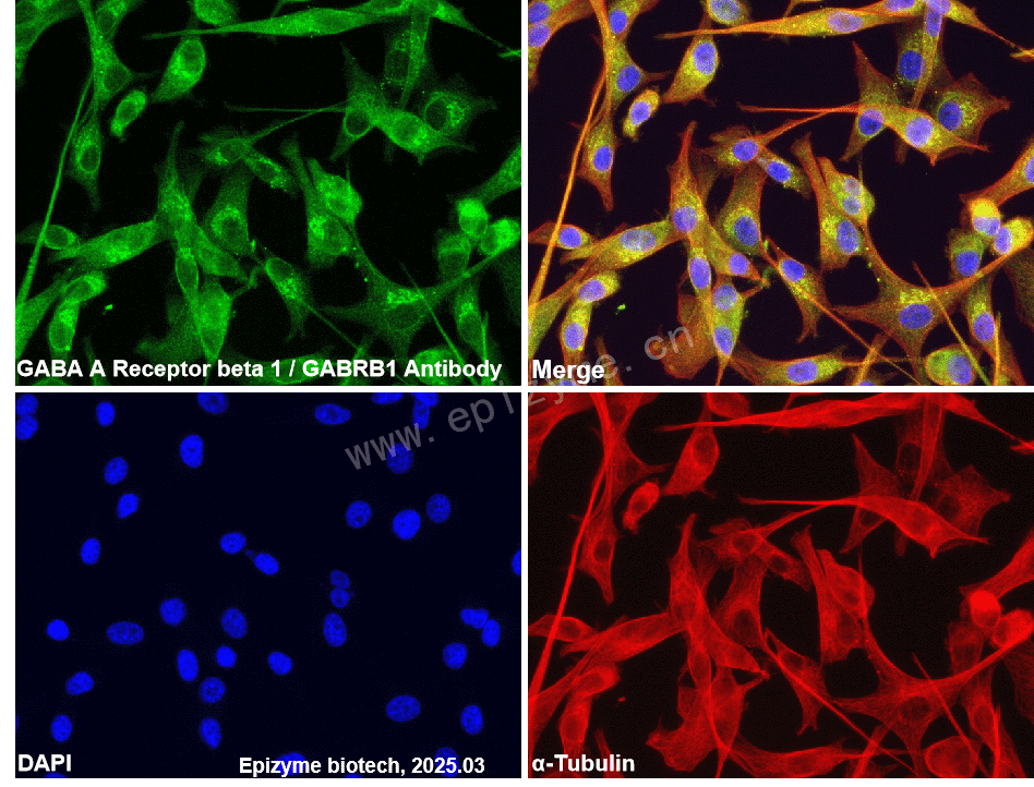 Anti-GABRB1 Rabbit mAb [62C69M90]