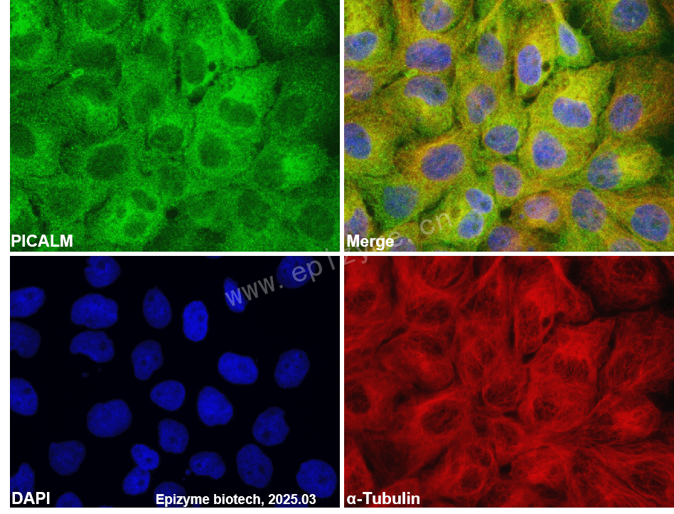 Anti-PICALM Rabbit mAb [23R67F04]