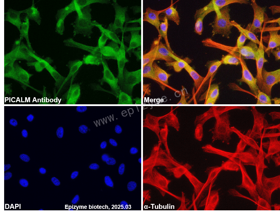 Anti-PICALM Rabbit mAb [23R67F04]