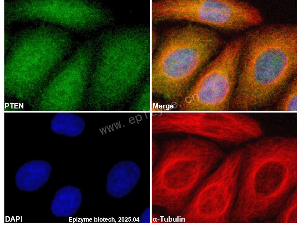 Anti-PTEN Rabbit mAb [44M47I64]