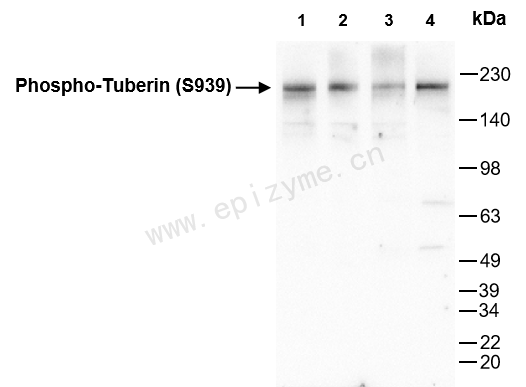Anti-Phospho-Tuberin (Ser939) Rabbit mAb [19N18E94]