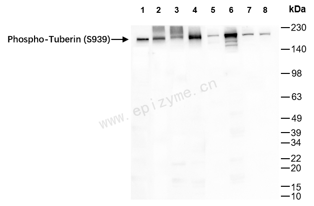 Anti-Phospho-Tuberin (Ser939) Rabbit mAb [19N18E94]