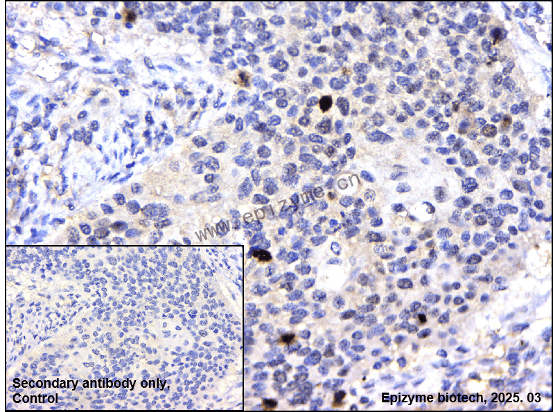 Anti-Phospho-c-Myc (Ser62) Rabbit mAb [30J99I94]