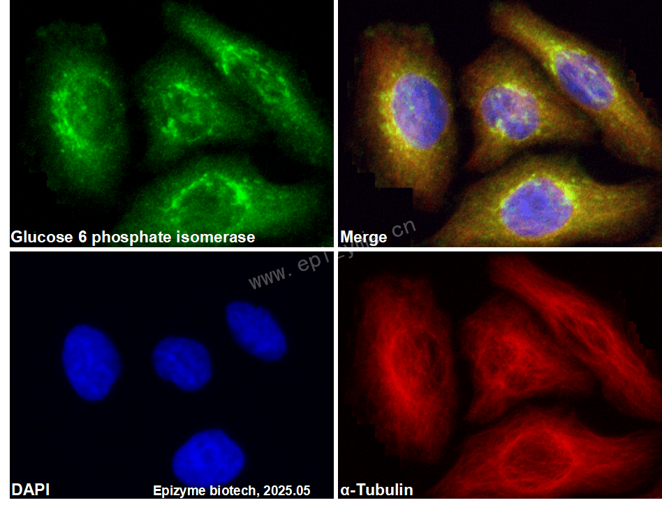 Anti-GPI/AMF Rabbit mAb [28T75T27]