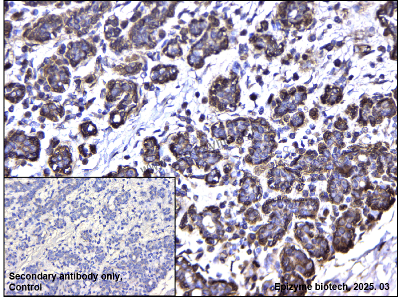 Anti-IRS2 Rabbit mAb [57F11H86]
