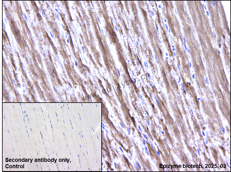Anti-IRS2 Rabbit mAb [57F11H86]