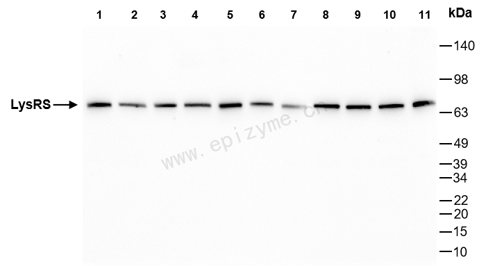 Anti-LysRS Rabbit mAb [94X32Q05]