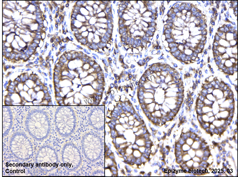 Anti-LysRS Rabbit mAb [94X32Q05]