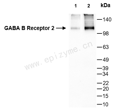 Anti-GABBR2 Rabbit mAb [66C46I94]