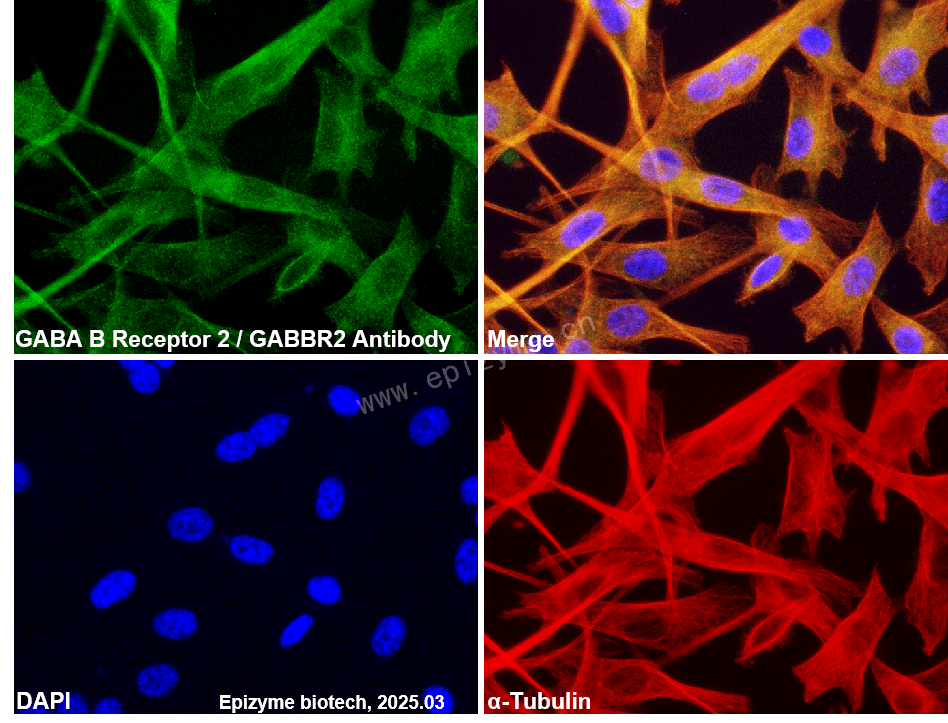 Anti-GABBR2 Rabbit mAb [66C46I94]