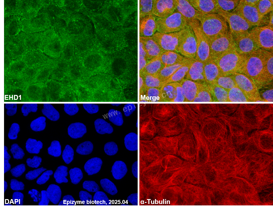 Anti-EHD1 Rabbit mAb [97C59C92]