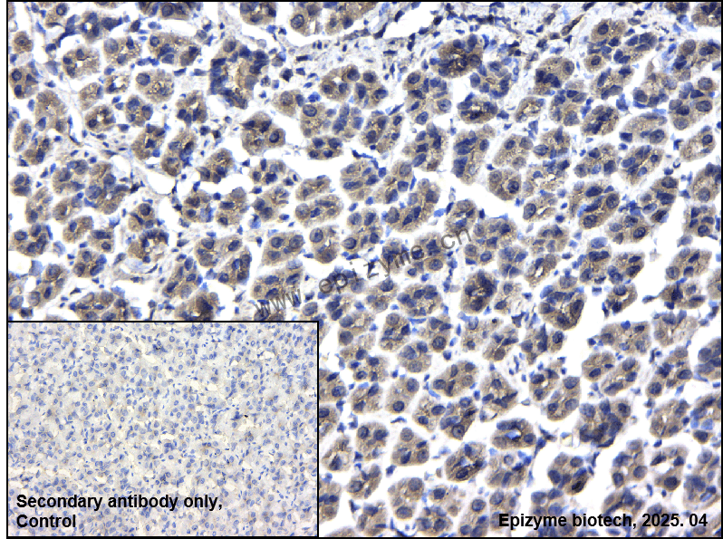 Anti-RAP1GAP Rabbit mAb [87S14F21]