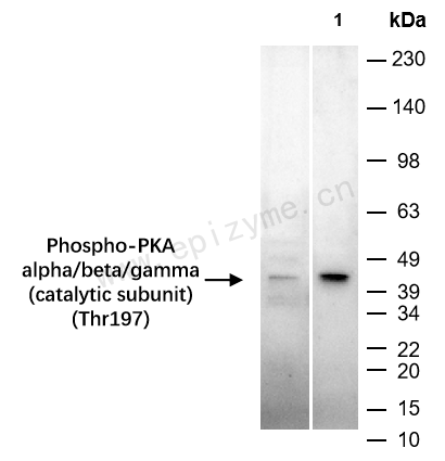 Anti-Phospho-PKA alpha/beta/gamma (catalytic subunit) (Thr197) Rabbit mAb [66S25I17]