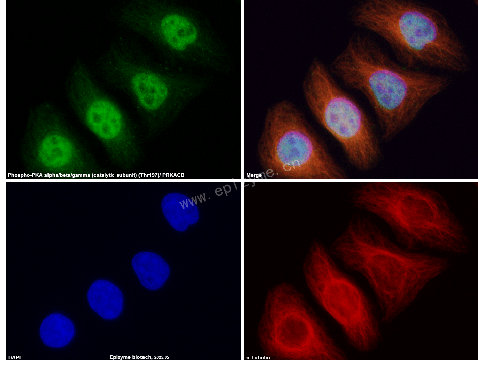 Anti-Phospho-PKA alpha/beta/gamma (catalytic subunit) (Thr197) Rabbit mAb [66S25I17]