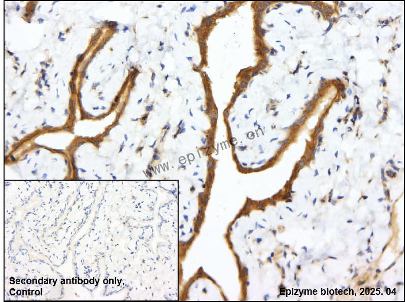 Anti-Keap1 Rabbit mAb [63T27Q33]