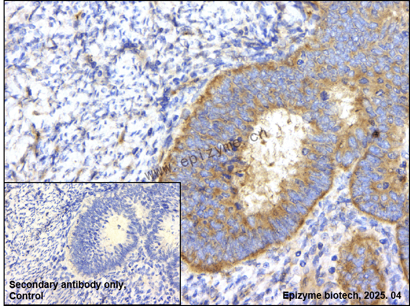 Anti-Keap1 Rabbit mAb [63T27Q33]