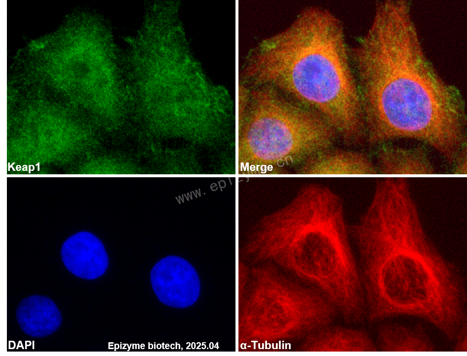 Anti-Keap1 Rabbit mAb [63T27Q33]