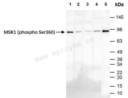 Anti-Phospho-MSK1 (Ser360) Rabbit mAb [65X84P97]