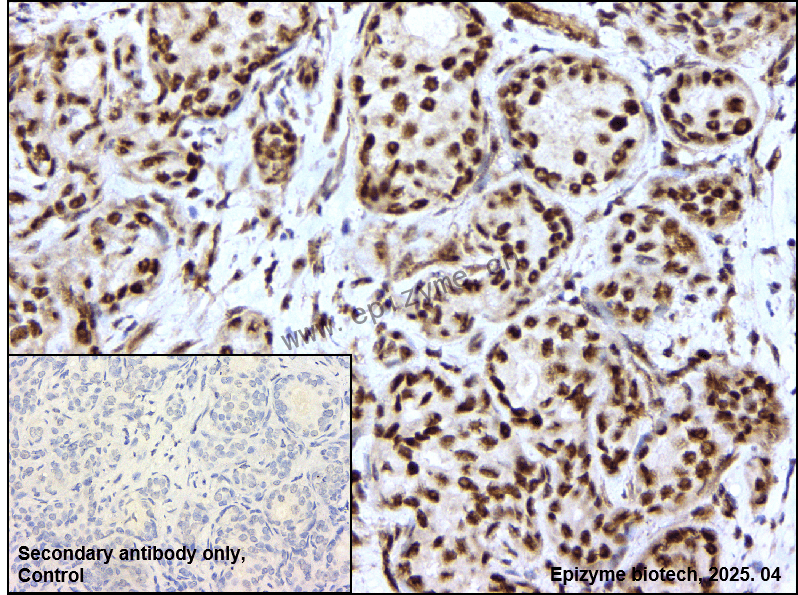 Anti-Phospho-MSK1 (Ser360) Rabbit mAb [65X84P97]
