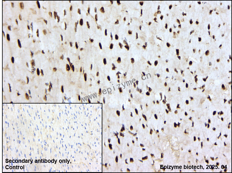 Anti-Phospho-MSK1 (Ser360) Rabbit mAb [65X84P97]