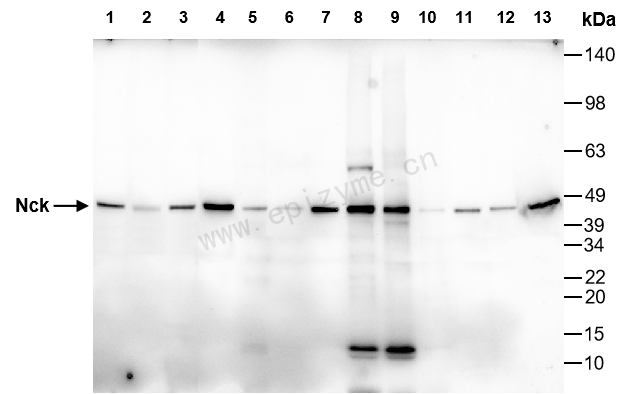 Anti-NCK1 Rabbit mAb [44D59B59]