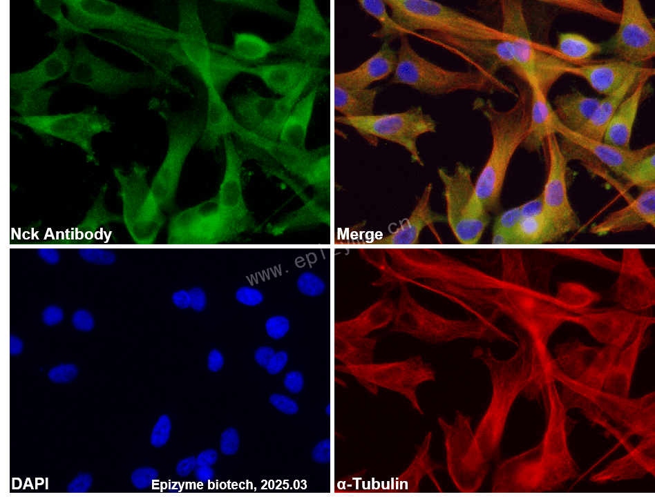Anti-NCK1 Rabbit mAb [44D59B59]