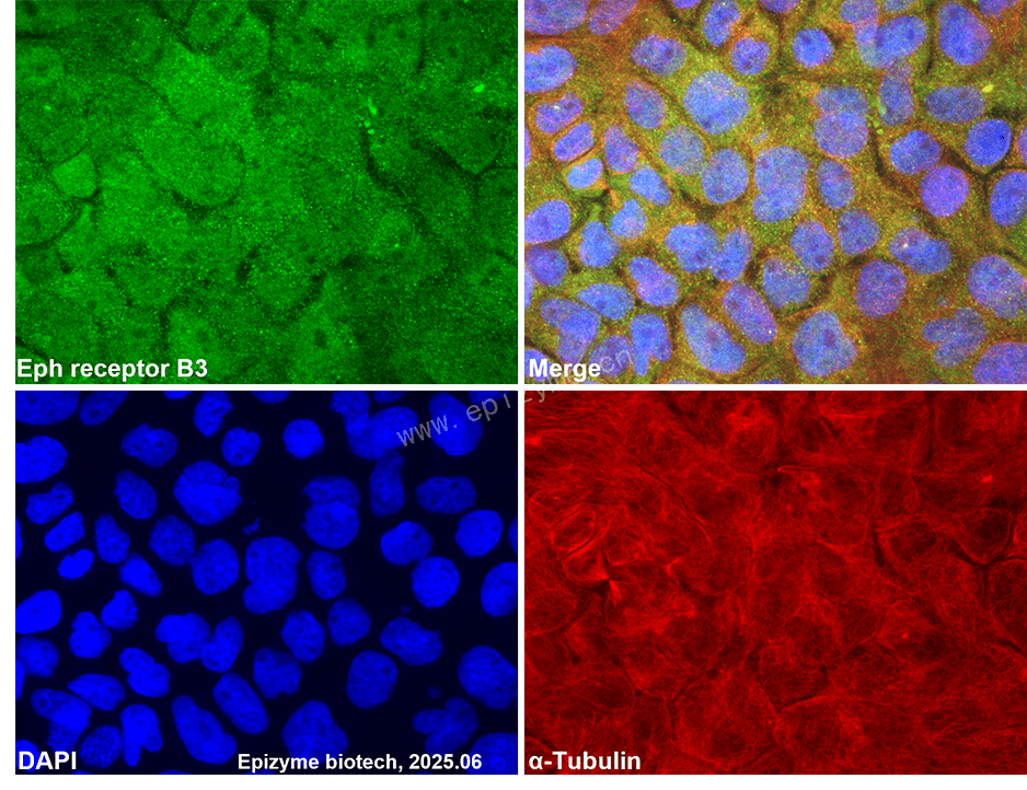 Anti-Eph receptor B3 Rabbit mAb [69D36T68]