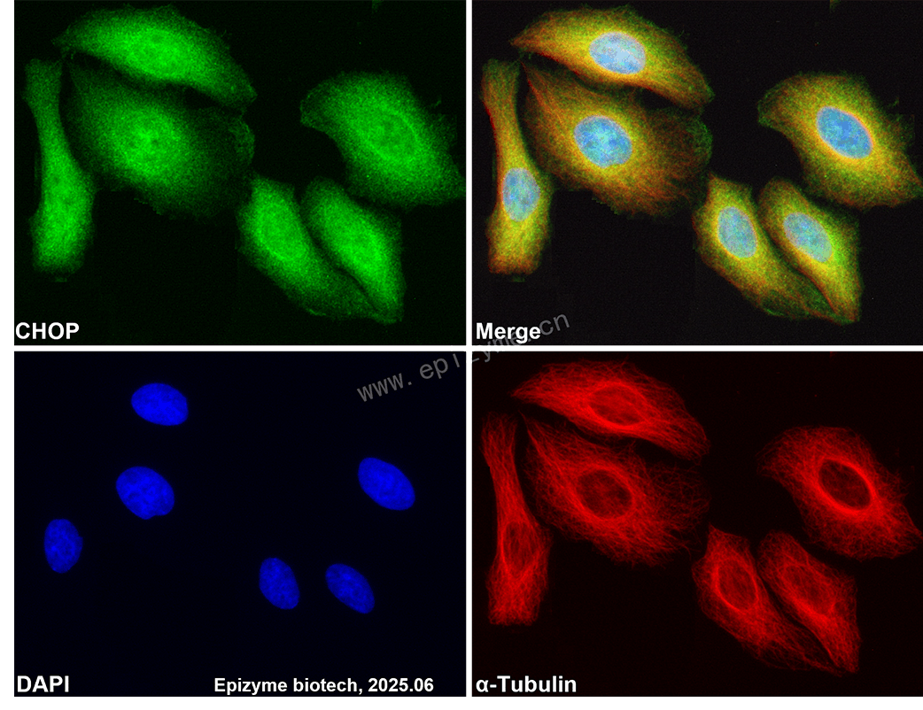 Anti-DDIT3 Rabbit mAb [57I29N31]