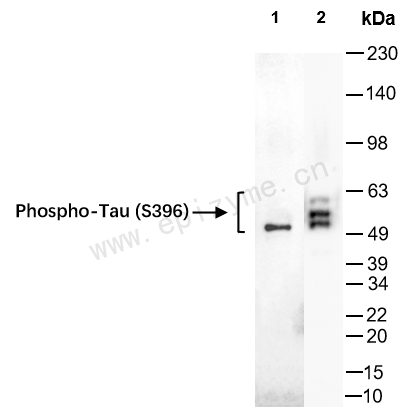 Anti-Phospho-Tau (Ser396) Rabbit mAb [55F99N54]