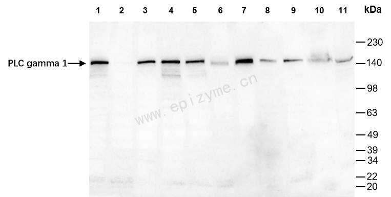 Anti-PLCG1 Rabbit mAb [70H11T65]