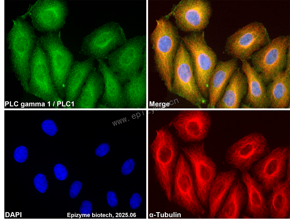 Anti-PLCG1 Rabbit mAb [70H11T65]