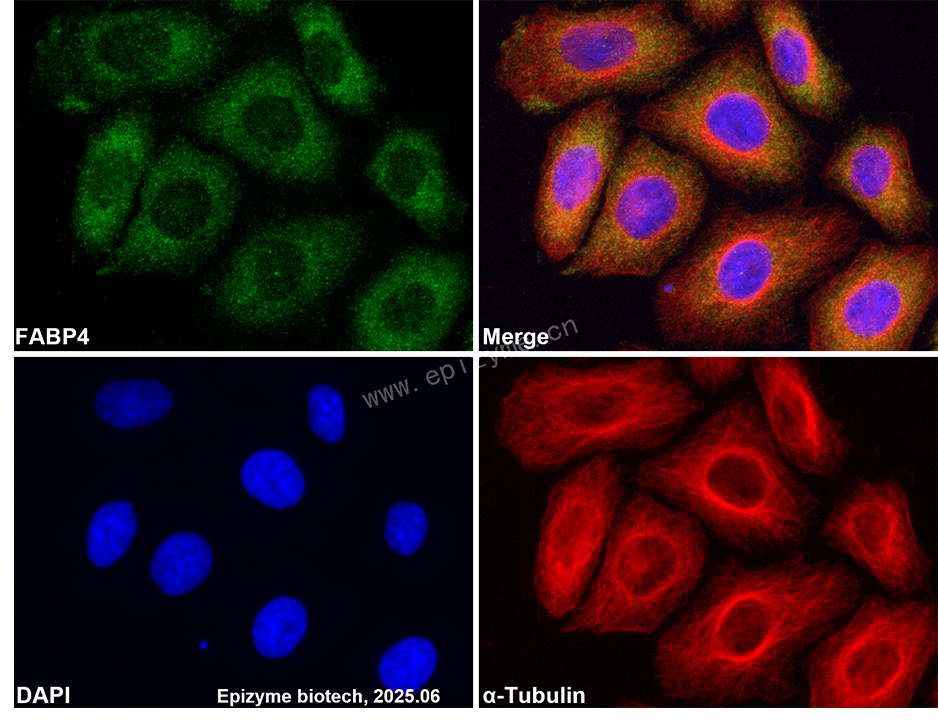 Anti-FABP4 Rabbit mAb [27P05M30]