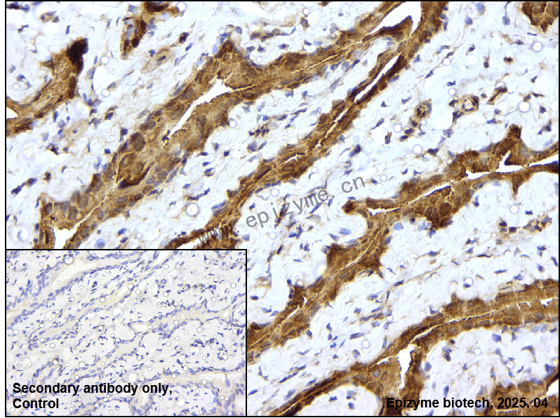 Anti-FABP4 Rabbit mAb [27P05M30]
