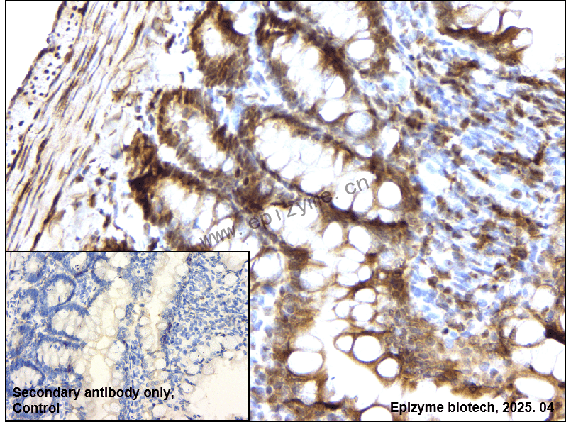 Anti-TFII I Rabbit mAb [75I86A99]