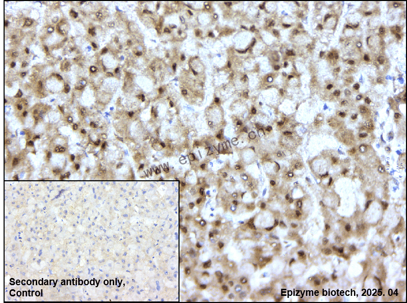 Anti-TFII I Rabbit mAb [75I86A99]
