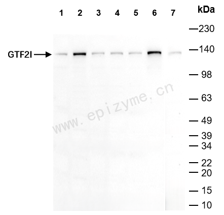 Anti-TFII I Rabbit mAb [75I86A99]