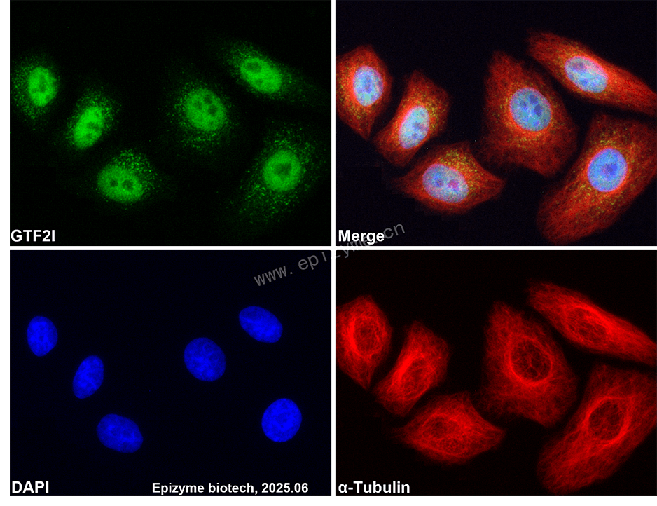 Anti-TFII I Rabbit mAb [75I86A99]