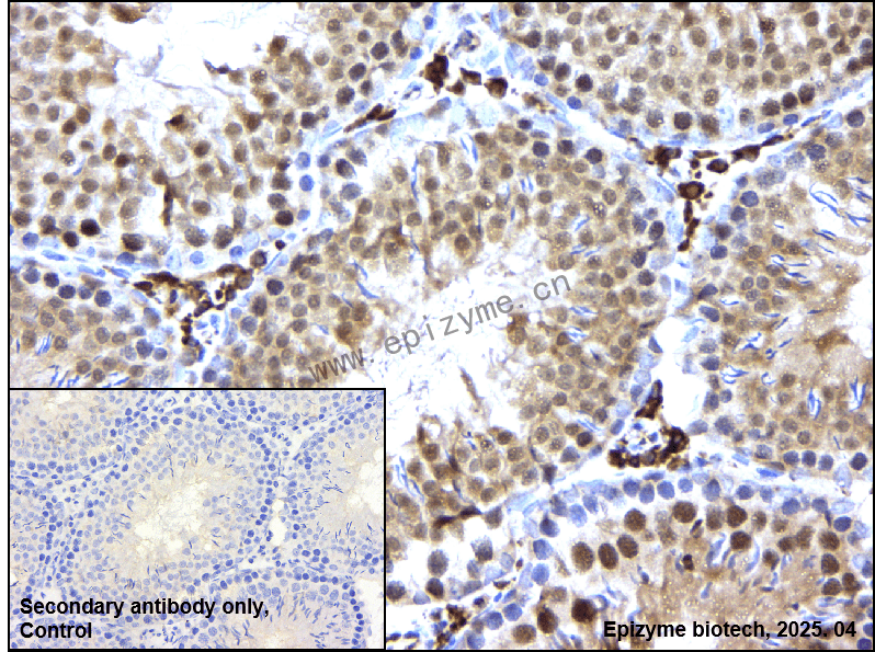 Anti-Importin 9 Rabbit mAb [48C25L00]