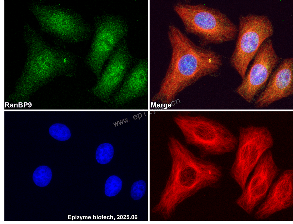 Anti-Importin 9 Rabbit mAb [48C25L00]