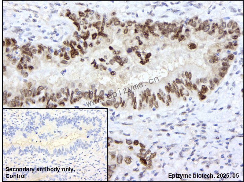 Anti-RCC1 Rabbit mAb [59A49B22]