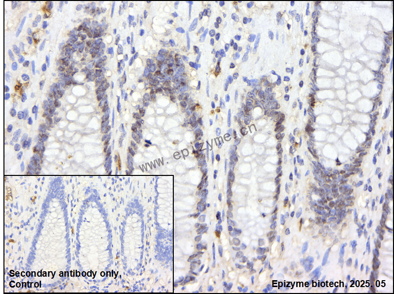 Anti-RCC1 Rabbit mAb [59A49B22]